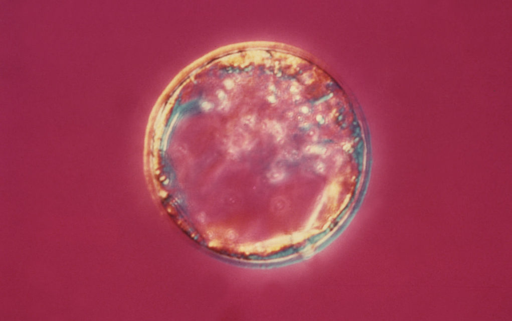 blastocyst-stage-e1491577994107.jpg