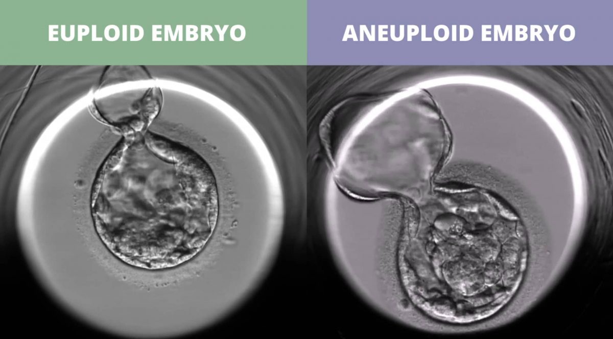 euploid_vs_uneuploid-1200x663.jpg